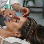 Microneedling in Den Haag: Ontdek de Geheimen van Stralende Huidverjonging en Verbeterde Huidstructuur