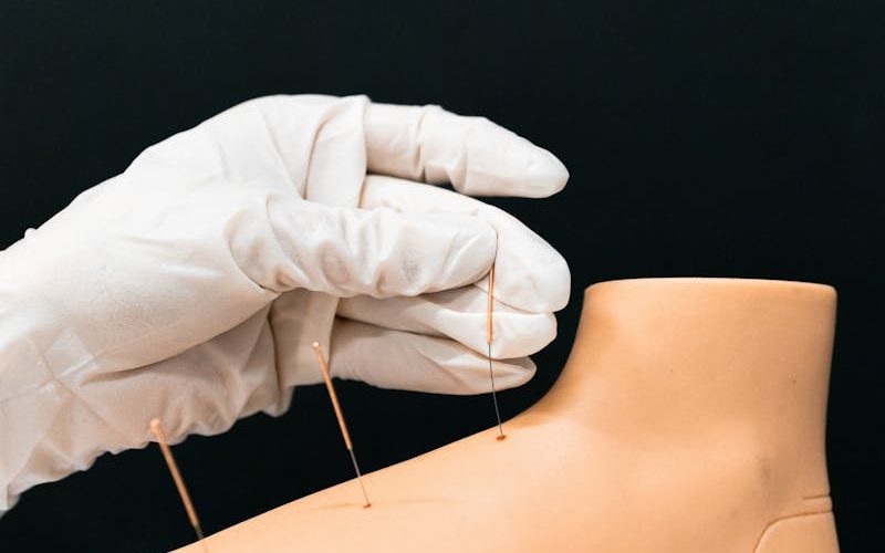 Close-up of hands performing acupuncture on an artificial foot model for educational purposes.