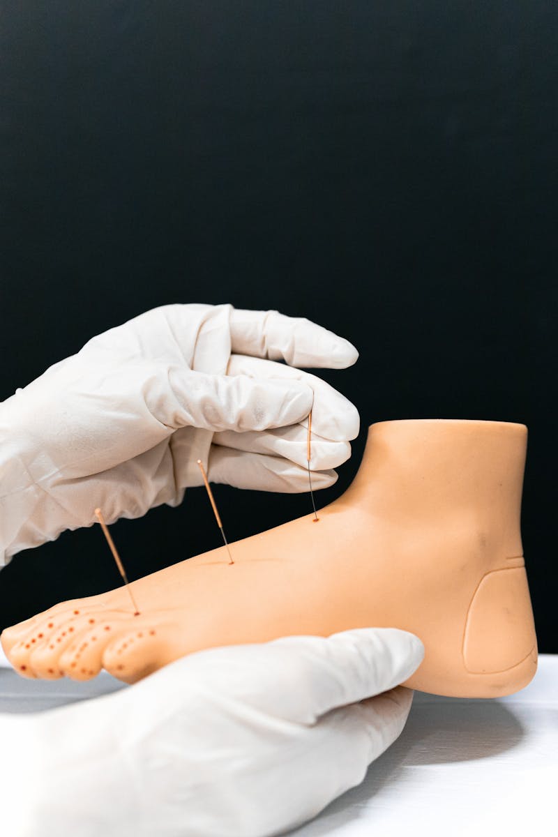 Close-up of hands performing acupuncture on an artificial foot model for educational purposes.
